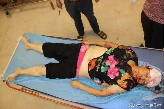 遠光燈造成重大交通事故，一名行人當場死亡！事故現場慘不忍睹！