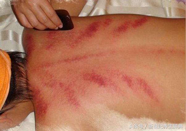 肩周炎的四大類型及其治療方法，快轉給身邊需要的人~