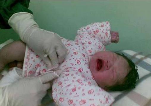 剛生完寶寶突然想上廁所，醫生聽後臉都變了，二次手術才保住性命