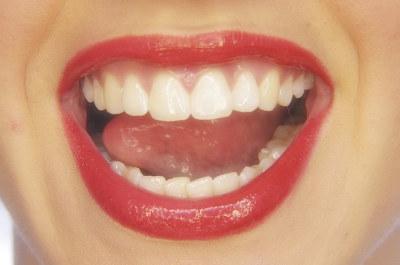 嘴裡出現這個症狀 是胃癌來襲信號！趕緊對照看看