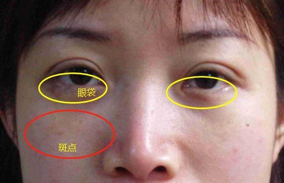 老中醫推薦用它洗臉，50歲大娘10年斑點，三周皮膚光滑，美白祛斑