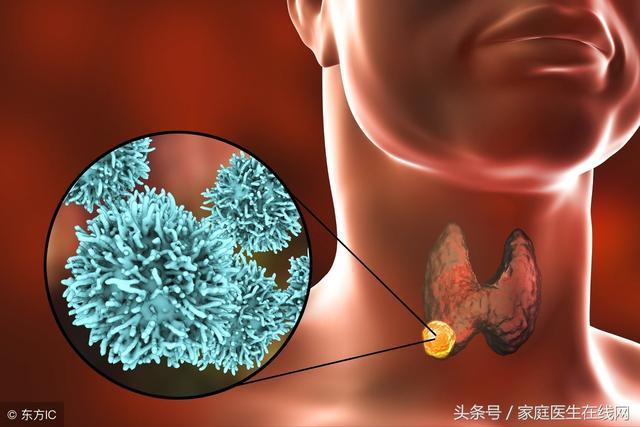 身體突然出現這8個症狀,是大病降臨的信號,早治療早好