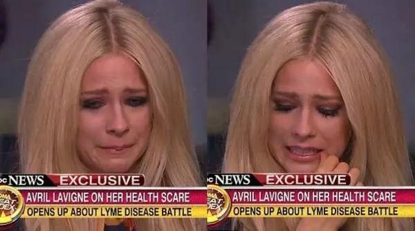 恐怖！被這種蟲咬到包你生不如死！23歲女子被咬，受不了要求安樂死…..案例太多了，一定要注意！