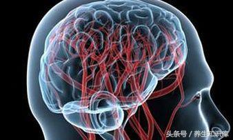 警惕:腦血管要「崩潰」的10大信號,早發現,或許能救命!