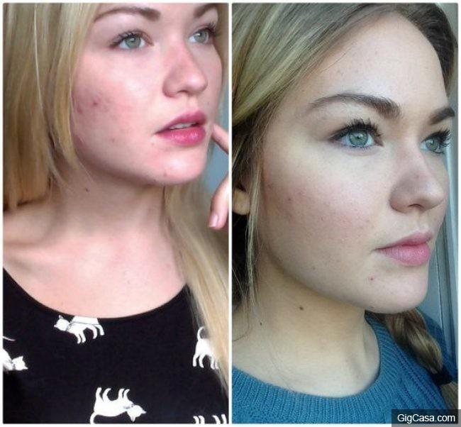 10種不用花大錢又超有效的「天然身體保養秘方」！10分鐘改善黑眼圈眼袋！