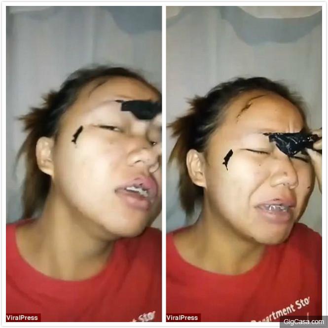 女子太想清粉刺沒看說明書，撕下麵膜後「之後照」讓網友為她默哀...