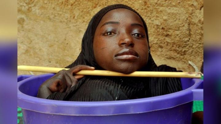 這個19歲女孩在6個月大時「身體就莫名停止生長」終生只能住在臉盆裡，看到她的身體連醫生都不敢相信…