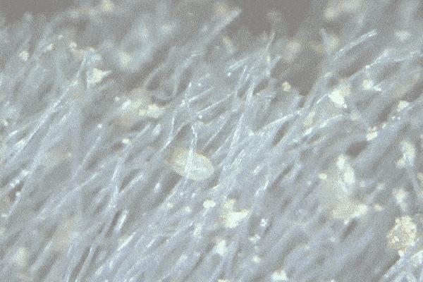 皮膚上這3種東西，是蟎蟲在「做窩」了！ 這3個方法除蟎最快！