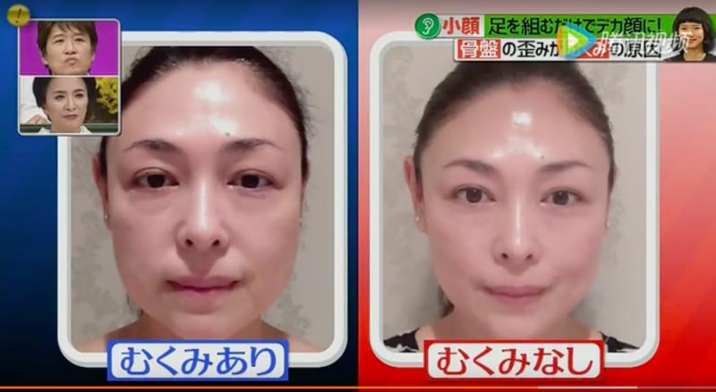 小顏矯盆拉筋法