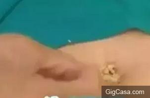 一女子把生薑片放在肚臍上,沒想到第二天竟然....真是驚呆所有人!