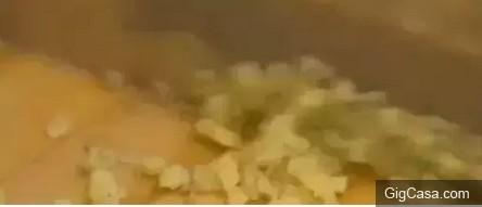 一女子把生薑片放在肚臍上,沒想到第二天竟然....真是驚呆所有人!