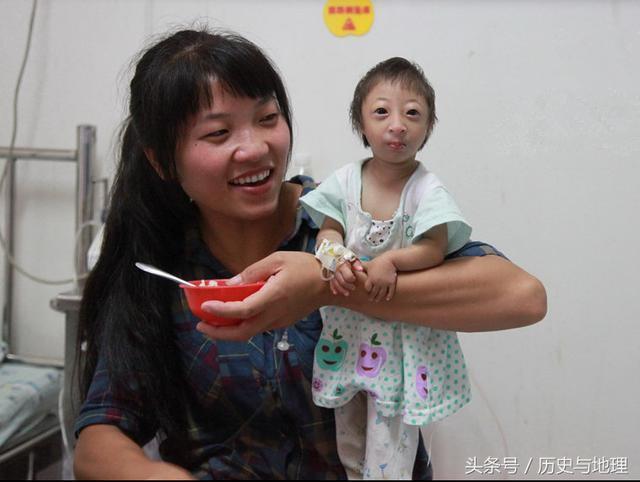 直擊罕見的袖珍寶寶，媽媽的笑臉讓人溫暖