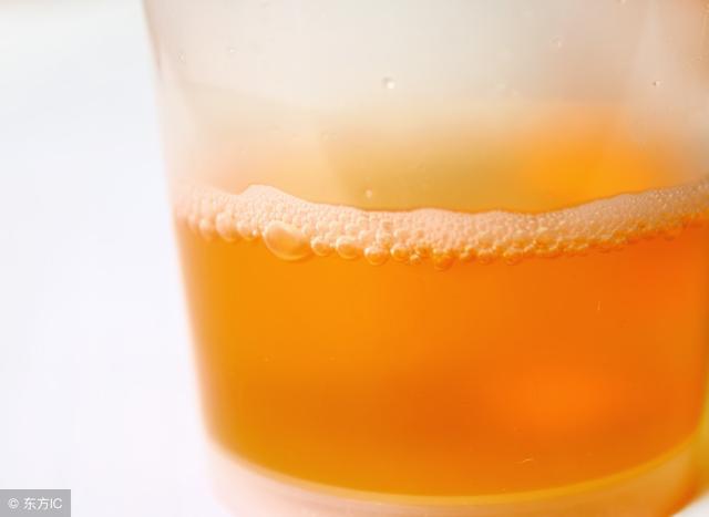 男人晨起後 如果身體有這幾個特點：說明腎臟比較好 不妨自測