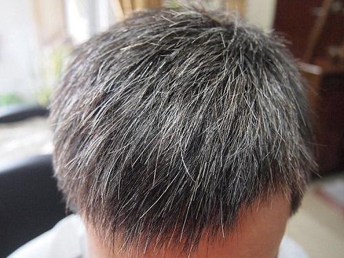  白髮越來越多？因為你經常吃這三種食物！最好少吃點…