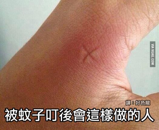 阿嫲祖傳秘方? 被蚊子咬後,止癢最效的方法!第5種方法,你一定從小到大都try過!