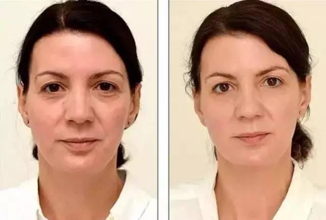 不喝飲料，喝足水，30天後你的身體會有怎樣的改變？