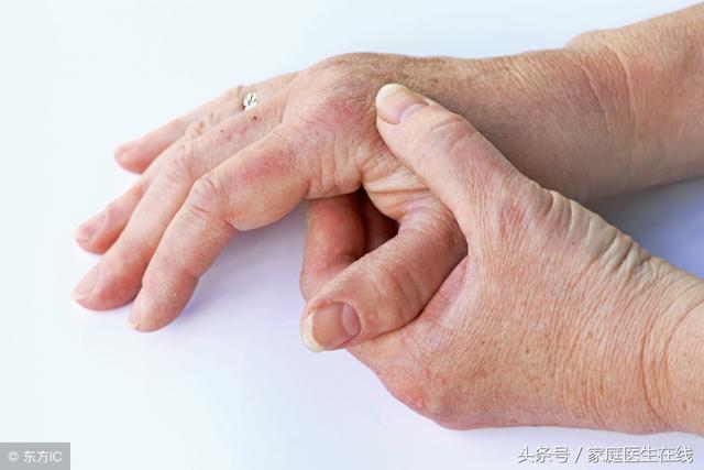關節炎和痛風傻傻分不清楚?認清5個不同,就不會再混淆了