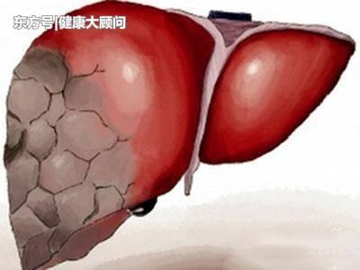 19歲女大學生查出肝癌離世,醫生解釋:都怪她經常這樣吃!比砒霜還要毒!