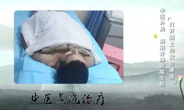 腿腳發涼、發麻？嚴重者可截肢！提醒身邊人警惕這種疾病！