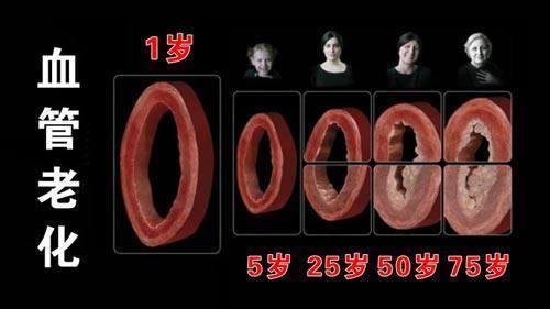 醫生告誡：4個徵兆說明你的血管堵塞，血液粘稠如粥，早送醫，能活命！