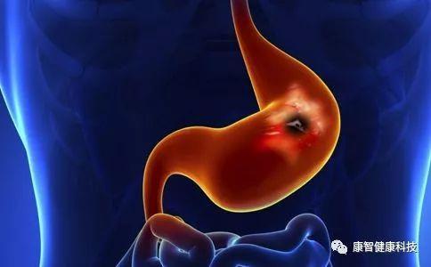 都說胃病難治，難在什麼地方：胃病怎樣才好得快！