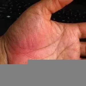 手掌上這塊肉，一看就知道你身體好不好，很靈哦！