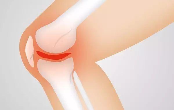 三成50歲以上女性患骨質疏松，補鈣的最佳時期你錯過了嗎？