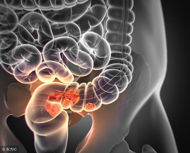 哪種排便習慣預示著腸癌？測試一下你是否有腸道隱患！
