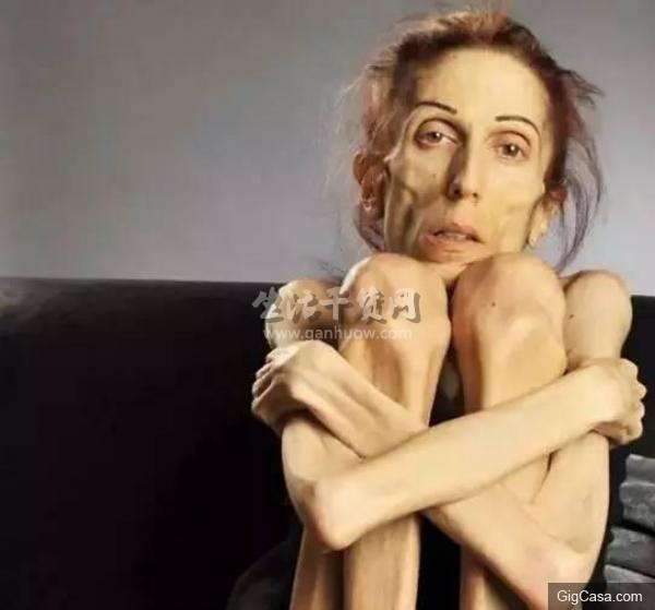 37歲的她瘦得只剩18公斤,連醫生都對她的病束手無措,沒想到丈夫竟然用「這種東西」來為她治療….如今的她已經….