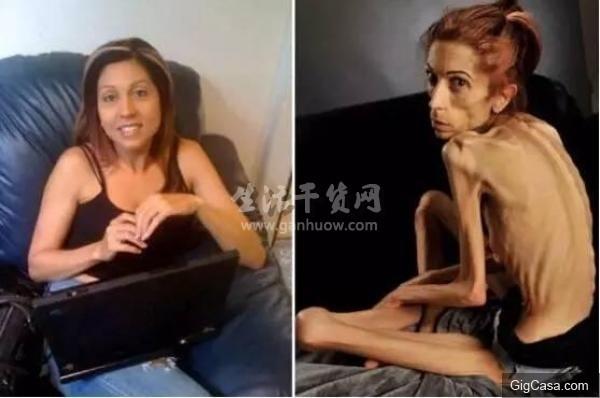 37歲的她瘦得只剩18公斤,連醫生都對她的病束手無措,沒想到丈夫竟然用「這種東西」來為她治療….如今的她已經….