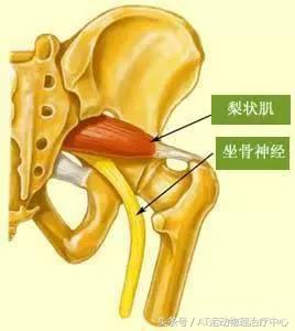「醫生，我久坐腰不疼，但是腿麻屁股疼是怎麼回事？」