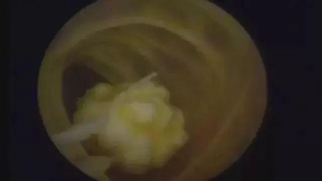 八成老年人膝關節軟骨磨得剩一半!簡單一招,延緩關節衰老!人人需要~