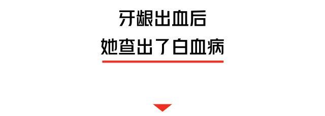 深圳女生刷牙見血,以為上火,一查竟是白血病!牙齦出血的人小心了