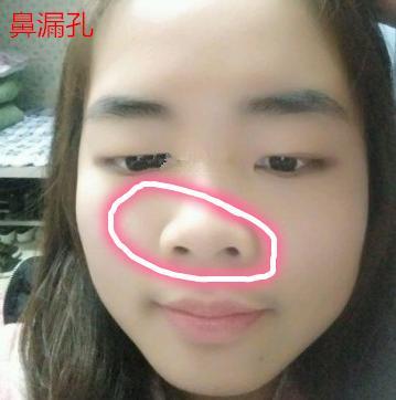 三種鼻子一生【難富貴】，希望你沒有！