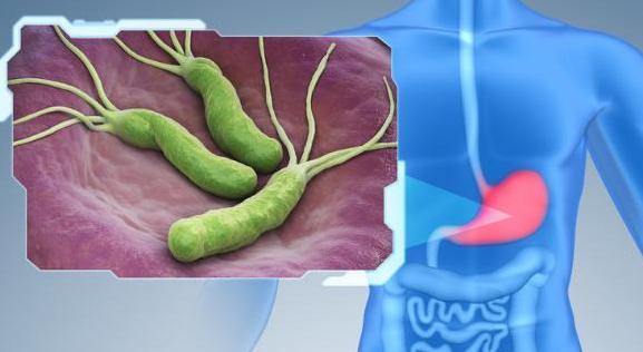 幽門螺桿菌纏上胃，身體會出現4個症狀，做3件事及時調理！