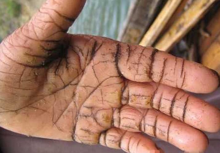 每天徒手綁鐵絲4000次，偉大母親徒手養大3個子女直到成家立業！看到她的手時大家心都碎了！