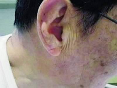失傳已久的偏方，能將血管洗到乾乾淨淨！效果非常好！