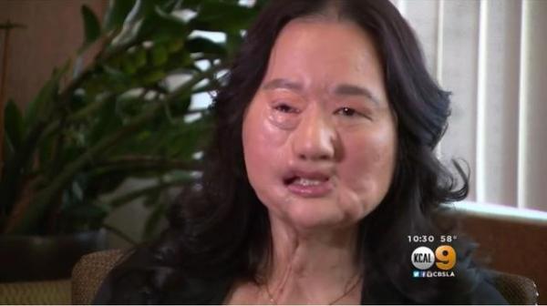 28歲時她被丈夫嚴重家暴,戴了12年麵具,孩子只能聽聲音認她