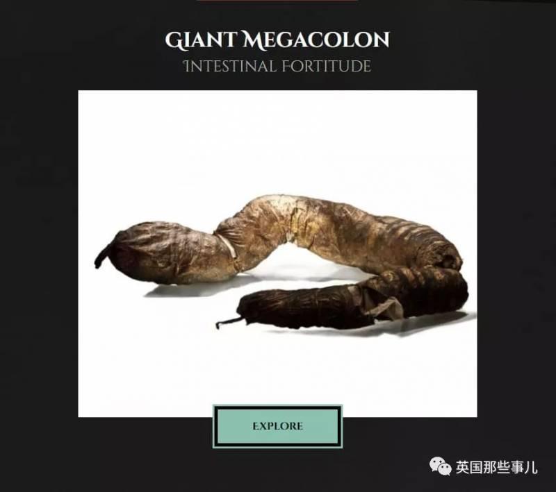 他是「全世界擁有最大啤酒肚」的男性，在他離世後，醫生剖腹竟發現原來他肚子裡裝的都是「這些」！