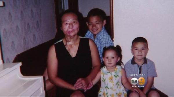 28歲時她被丈夫嚴重家暴,戴了12年麵具,孩子只能聽聲音認她