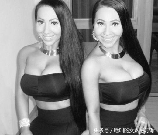 雙胞胎花百萬整容成一模一樣,嫁給同一個男人同步懷孕,現怎樣了