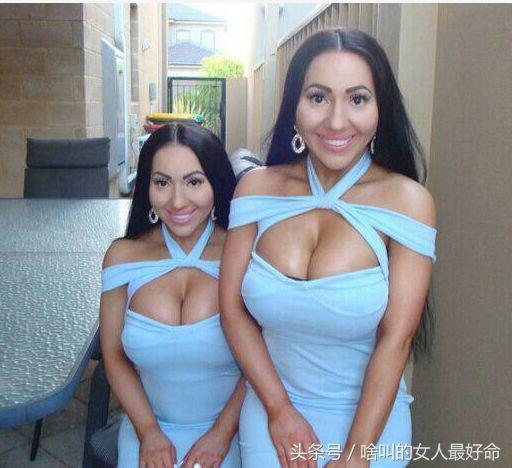 雙胞胎花百萬整容成一模一樣,嫁給同一個男人同步懷孕,現怎樣了