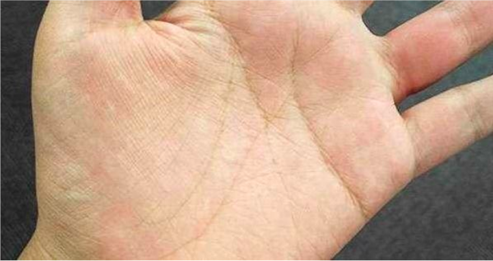 手掌有特殊「m字型」掌纹的人,少有的福星,有这种手相的真不多,个个都